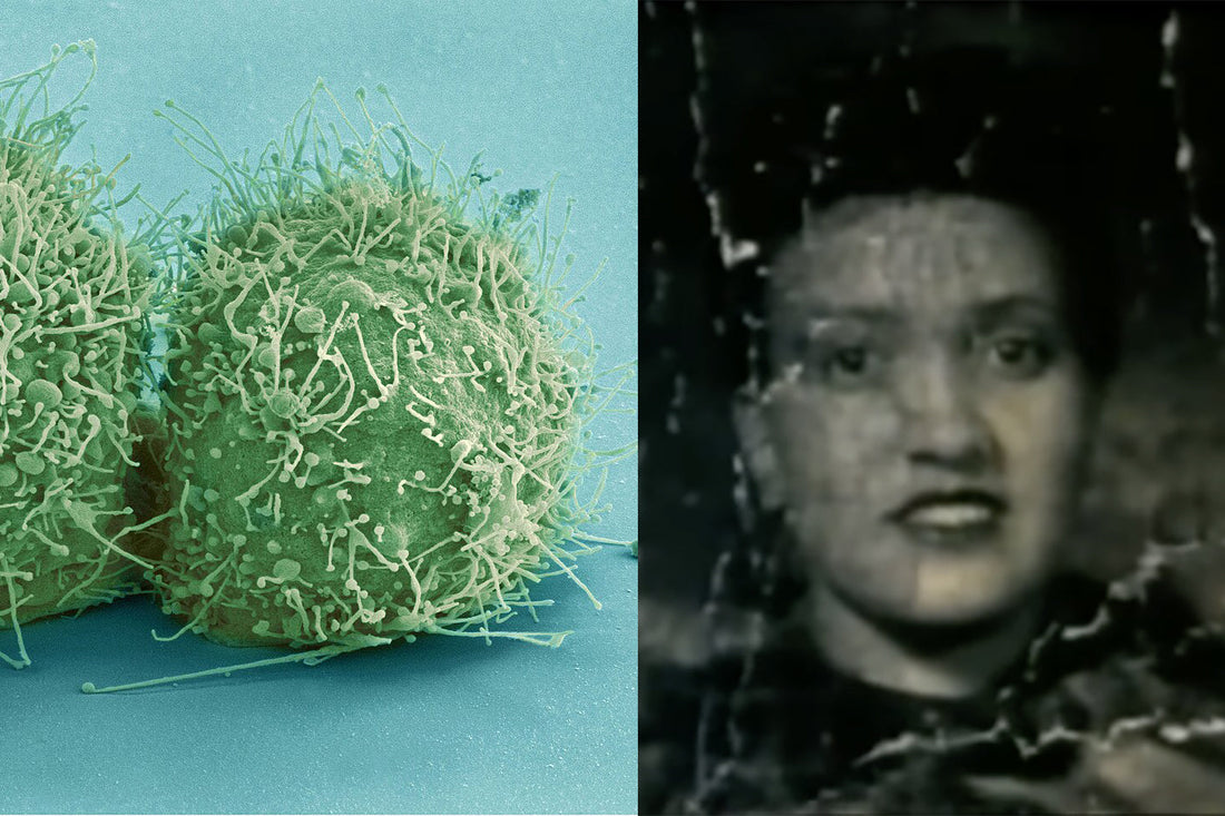 The Immortal Cells of Henrietta Lacks