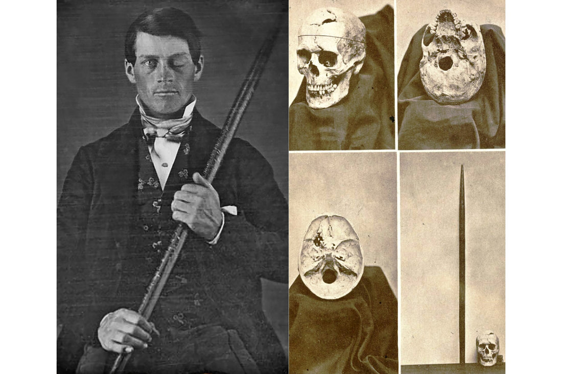 Phineas Gage